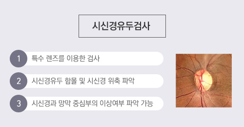 시신경유두검사